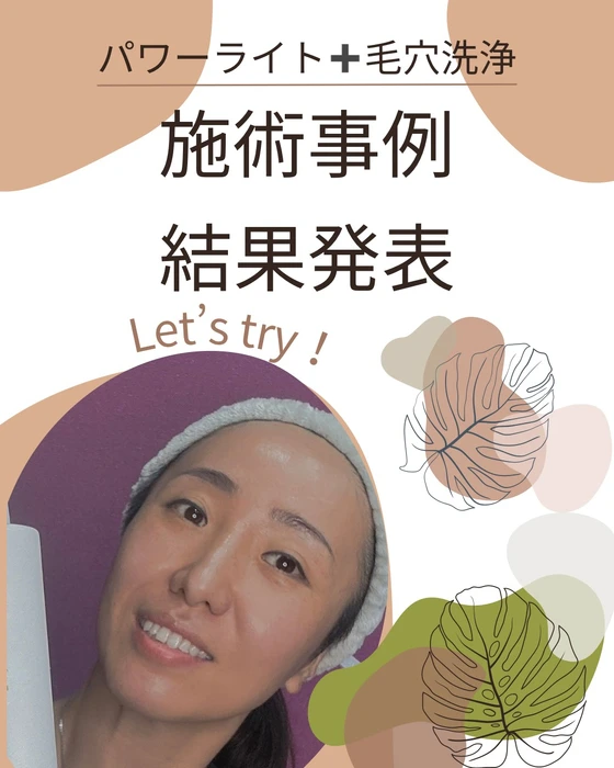 画像404