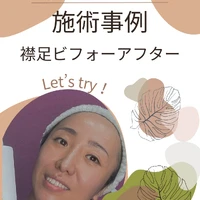 画像410