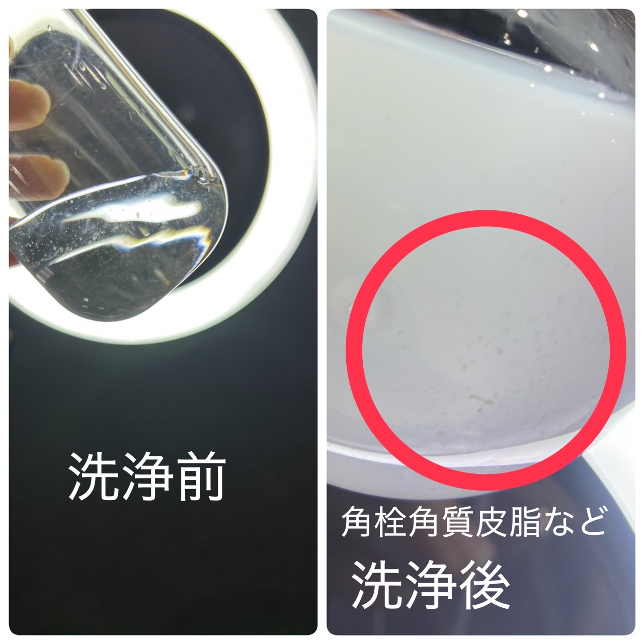 4. 角質ケアの新常識