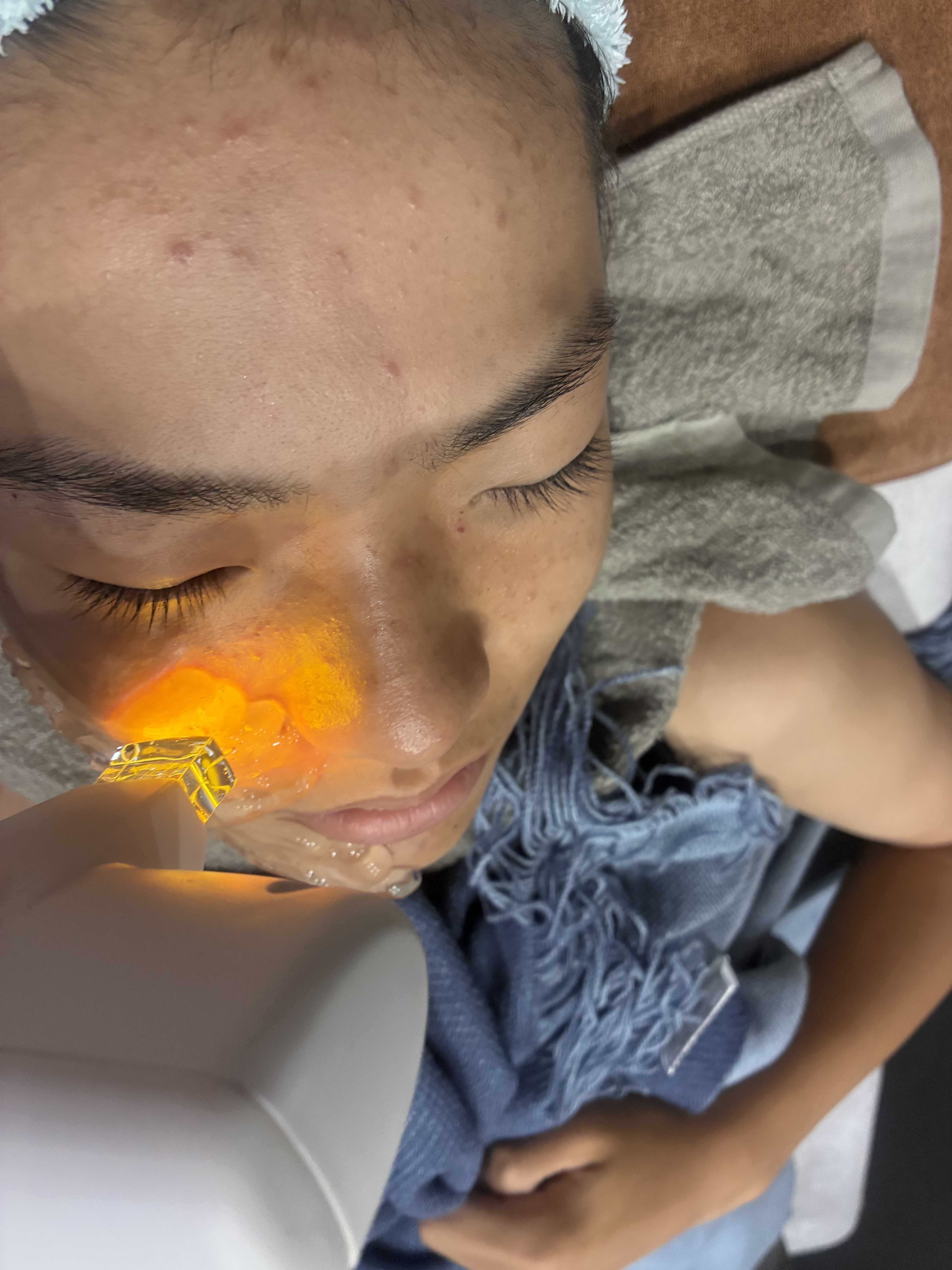 実際の施術内容と効果